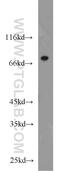 Casein Kinase 1 Alpha 1 Like antibody, 17125-1-AP, Proteintech Group, Western Blot image 