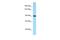 Interacts With SUPT6H, CTD Assembly Factor 1 antibody, A05958, Boster Biological Technology, Western Blot image 