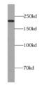 TSC Complex Subunit 2 antibody, FNab09101, FineTest, Western Blot image 