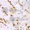 Keratin 15 antibody, A2660, ABclonal Technology, Immunohistochemistry paraffin image 