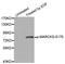 Myristoylated Alanine Rich Protein Kinase C Substrate antibody, STJ22281, St John