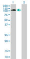 Protein Tyrosine Kinase 2 Beta antibody, LS-C197191, Lifespan Biosciences, Western Blot image 