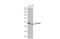 Protein Arginine Methyltransferase 2 antibody, GTX103398, GeneTex, Western Blot image 