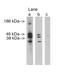 Ceramide Synthase 3 antibody, PA1-12923, Invitrogen Antibodies, Western Blot image 
