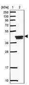 Glucosaminyl (N-Acetyl) Transferase Family Member 7 antibody, PA5-62651, Invitrogen Antibodies, Western Blot image 