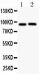 Potassium Voltage-Gated Channel Subfamily B Member 1 antibody, PB9111, Boster Biological Technology, Western Blot image 