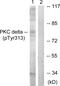 Protein Kinase C Delta antibody, PA5-38385, Invitrogen Antibodies, Western Blot image 