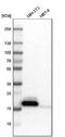 NPC Intracellular Cholesterol Transporter 2 antibody, NBP1-84012, Novus Biologicals, Western Blot image 