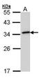 NAD(P)H Quinone Dehydrogenase 1 antibody, GTX101285, GeneTex, Western Blot image 