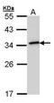 DT-diaphorase antibody, GTX101285, GeneTex, Western Blot image 