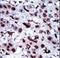 Adenylate Kinase 5 antibody, LS-C101248, Lifespan Biosciences, Immunohistochemistry frozen image 