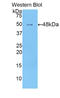 BCL2L2-PABPN1 Readthrough antibody, LS-C302522, Lifespan Biosciences, Western Blot image 
