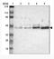 Alpha-N-Acetylgalactosaminidase antibody, NBP1-84318, Novus Biologicals, Western Blot image 