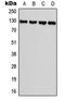 Transient Receptor Potential Cation Channel Subfamily M Member 8 antibody, LS-C353566, Lifespan Biosciences, Western Blot image 