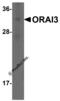 ORAI Calcium Release-Activated Calcium Modulator 3 antibody, PM-4911, ProSci, Western Blot image 