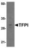 Tissue Factor Pathway Inhibitor antibody, LS-B10121, Lifespan Biosciences, Western Blot image 
