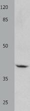 G Protein Subunit Alpha 11 antibody, TA323063, Origene, Western Blot image 