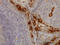 TNF Receptor Superfamily Member 6b antibody, LS-C133572, Lifespan Biosciences, Immunohistochemistry paraffin image 