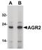 Anterior Gradient 2, Protein Disulphide Isomerase Family Member antibody, PA5-34517, Invitrogen Antibodies, Western Blot image 