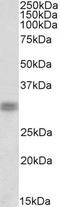 Cone-rod homeobox protein antibody, PA5-37855, Invitrogen Antibodies, Western Blot image 