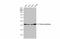 Citrate Synthase antibody, GTX110624, GeneTex, Western Blot image 