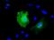 Kelch Repeat And BTB Domain Containing 7 antibody, GTX84282, GeneTex, Immunofluorescence image 