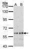 SLK antibody, GTX101189, GeneTex, Western Blot image 