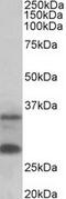 U6 snRNA phosphodiesterase antibody, MBS422774, MyBioSource, Western Blot image 