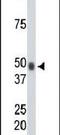 Choline Kinase Alpha antibody, PA5-13816, Invitrogen Antibodies, Western Blot image 