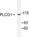 Phospholipase C Gamma 1 antibody, LS-C176182, Lifespan Biosciences, Western Blot image 