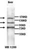 Adrenoceptor Alpha 1A antibody, orb77040, Biorbyt, Western Blot image 