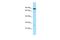 Membrane Spanning 4-Domains A7 antibody, A12262, Boster Biological Technology, Western Blot image 