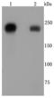 Integrin Subunit Beta 4 antibody, A01015, Boster Biological Technology, Western Blot image 