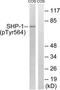 Protein Tyrosine Phosphatase Non-Receptor Type 6 antibody, TA326179, Origene, Western Blot image 