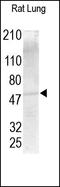 Matrix Metallopeptidase 13 antibody, 251219, Abbiotec, Western Blot image 