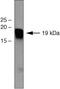 Unknown protein from 2D-PAGE of fibroblasts antibody, 37-8700, Invitrogen Antibodies, Western Blot image 