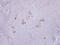 Phosphorylase Kinase Regulatory Subunit Alpha 1 antibody, LS-C186068, Lifespan Biosciences, Immunohistochemistry paraffin image 