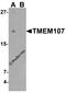 Transmembrane Protein 107 antibody, 7483, ProSci, Western Blot image 