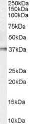 ACOX2 antibody, orb19454, Biorbyt, Western Blot image 