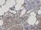 Neutral sphingomyelinase antibody, H00006610-M01, Novus Biologicals, Immunohistochemistry frozen image 