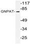 Glyceronephosphate O-Acyltransferase antibody, AP21060PU-N, Origene, Western Blot image 