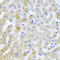 Eukaryotic Translation Initiation Factor 3 Subunit M antibody, LS-C333313, Lifespan Biosciences, Immunohistochemistry paraffin image 