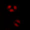 RB Transcriptional Corepressor Like 1 antibody, GTX55251, GeneTex, Immunofluorescence image 