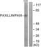 Paxillin antibody, LS-C118221, Lifespan Biosciences, Western Blot image 