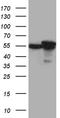 Chaperonin Containing TCP1 Subunit 4 antibody, TA810896S, Origene, Western Blot image 
