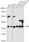 Tubulin Folding Cofactor B antibody, 14-870, ProSci, Western Blot image 