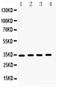 Cyclin Dependent Kinase 5 Regulatory Subunit 1 antibody, RP1060, Boster Biological Technology, Western Blot image 