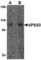 VPS53 Subunit Of GARP Complex antibody, TA306571, Origene, Western Blot image 