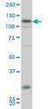 Homeodomain Interacting Protein Kinase 2 antibody, LS-B5460, Lifespan Biosciences, Western Blot image 