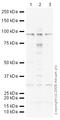 Glutamate Ionotropic Receptor NMDA Type Subunit 1 antibody, ab52177, Abcam, Western Blot image 